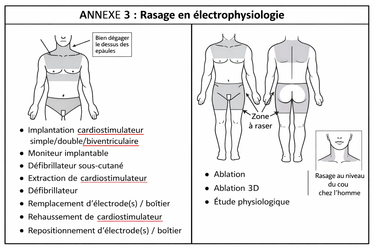 Zone de préparation cutanée pour ablation